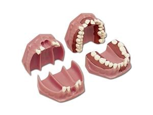 Orthodontie-Modell A-8 Modell