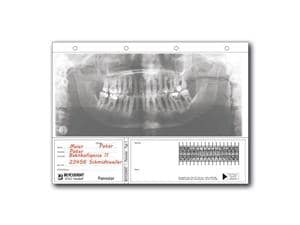 Panostar® Typ 1 - Startersystem Set