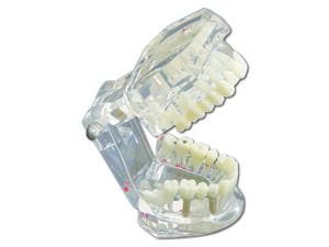 Studienmodell Schaumodell für Zahnkrankheiten