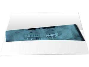 Röntgenkarteitasche Orthopantomograph (OPG) Packung 100 Stück