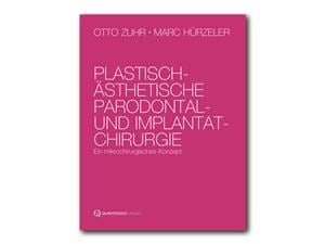 Plastisch - Ästhetische Parodontal- und Implantatchirurgie Buch