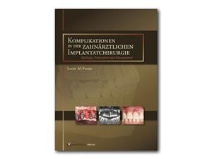Komplikationen in der zahnärtzlichen Implantatchirurgie Buch