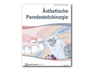 Ästhetische Parodontalchirurgie Stück