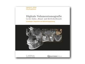 Digitale Volumentomografie in der Zahn-, Mund- und Kieferheilkunde Buch