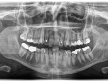 2d-roentgen