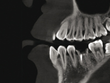 kachel-3d-roentgen